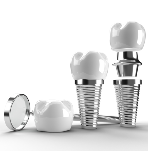 <a style="color:#000; text-decoration:none;" href="https://dentalfirst.care/en/services/#implantology-1">Implants</a>