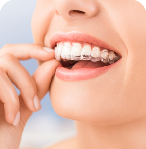 <a style="color:#000;text-decoration:none;" href="https://dentalfirst.canalcero.digital/en/services/#plans-10">Night Guard</a>